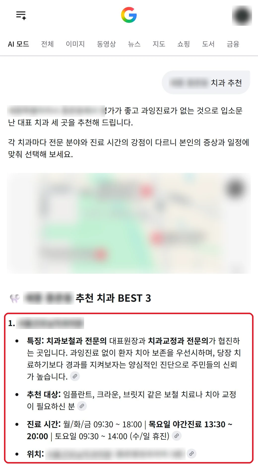 구글 AI 모드에 지역 치과 추천을 물은 답변. 추천 치과 BEST 3 중 1번이 벤트릭스 관리 치과이고 과잉진료 없이 치아 보존을 우선한다는 설명. 상호, 지역, 지도는 가림 처리